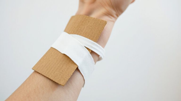 splint using wound dressing